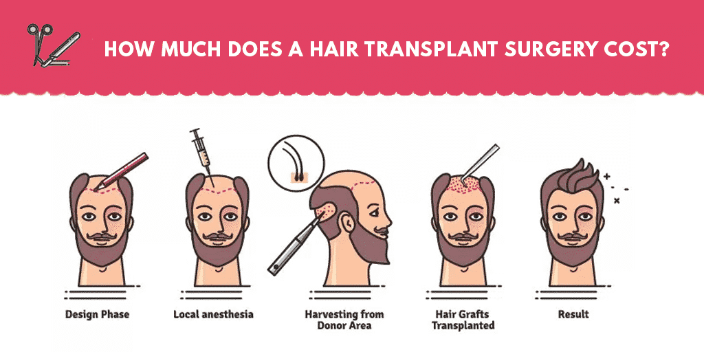 Hair Transplant Surgery Cost Learn How Much Does It Costs Hair Sure