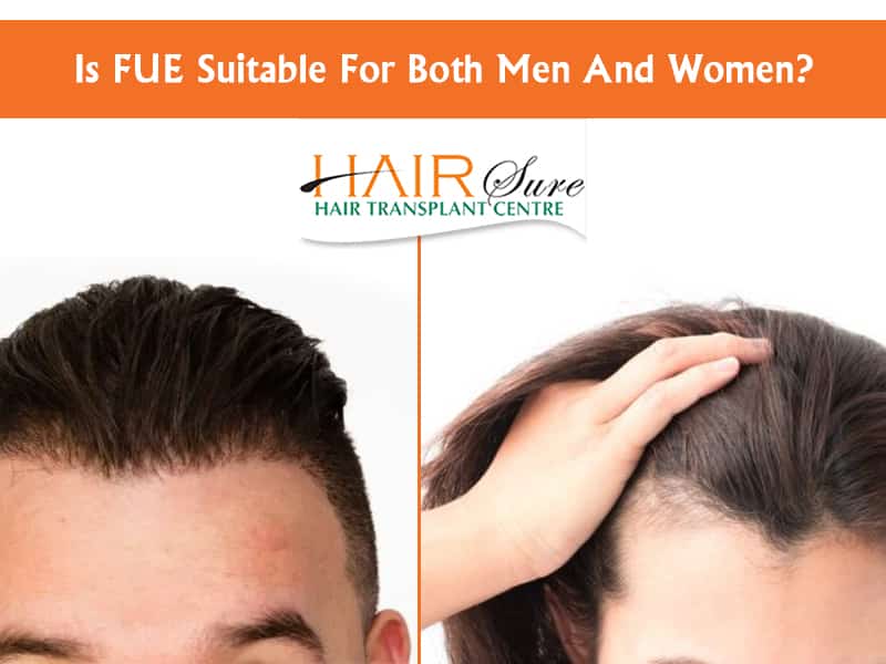 Is FUE Suitable For Both Men And Women? | Hair Sure