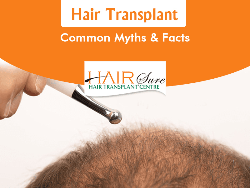 Hair Transplant – Common Myths & Facts | Hair Sure