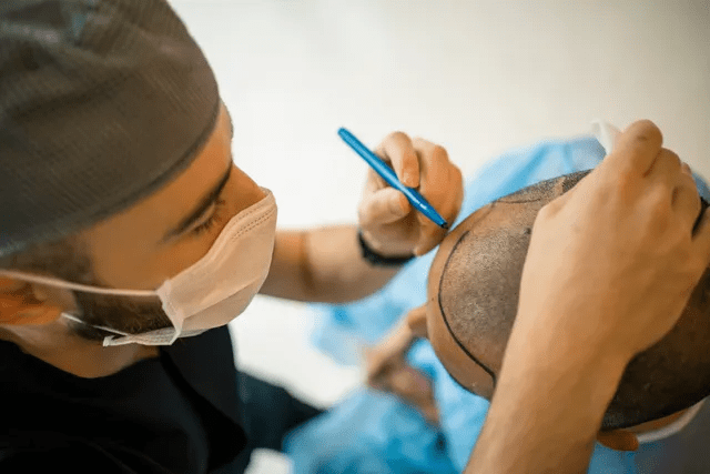 The best method for hair transplant in Hyderabad, hair care specialist near Uppal