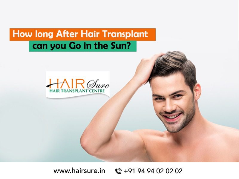 How long After Hair Transplant can you Go in the Sun? | Hair Sure
