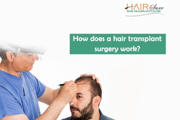 How does a hair transplant surgery work?