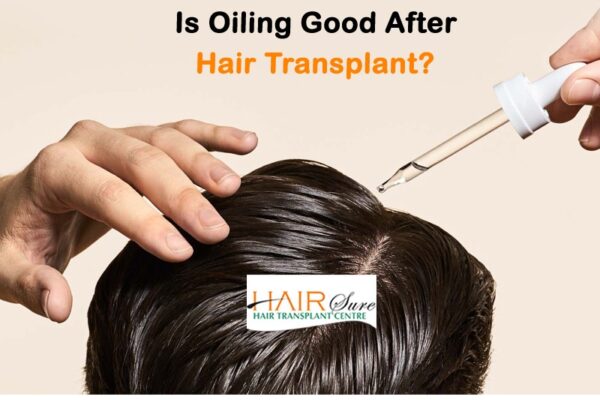Is Oiling Good After Hair Transplant?