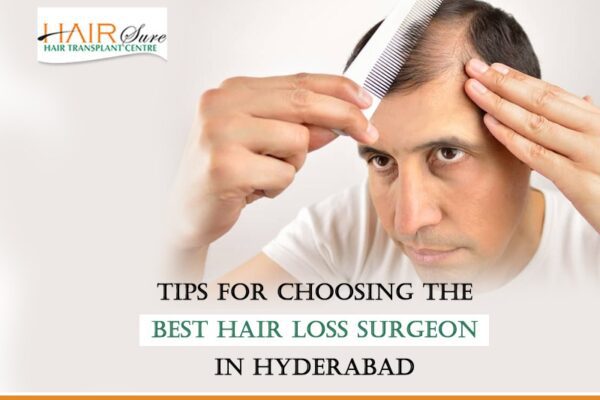 Tips for Choosing the best hair loss surgeon in Hyderabad