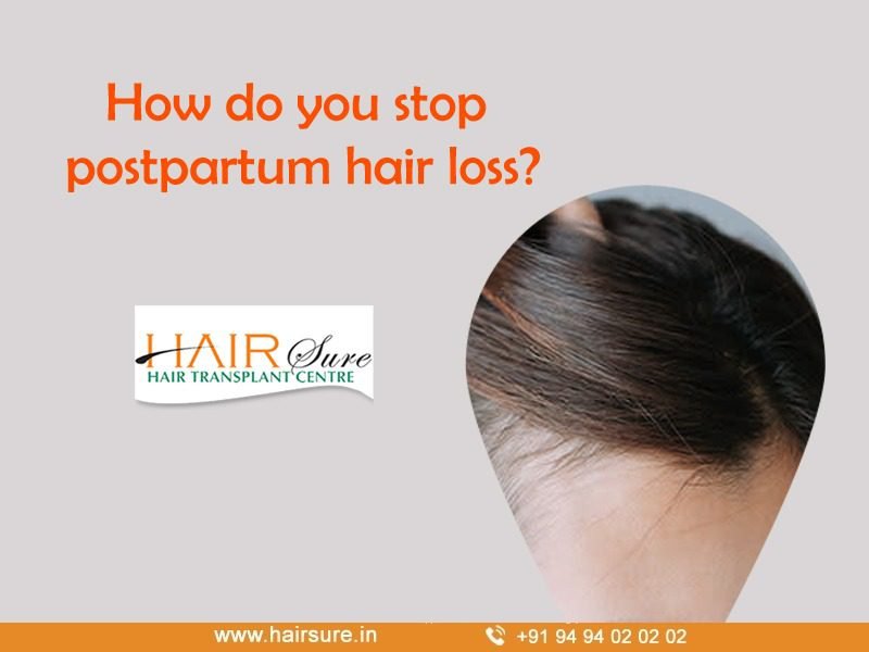 how-do-you-stop-postpartum-hair-loss-hair-sure